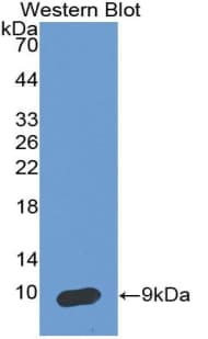 Monoclonal Mouse anti-Human SERPINB4 / SCCA1+2 Antibody (aa320-390, WB)