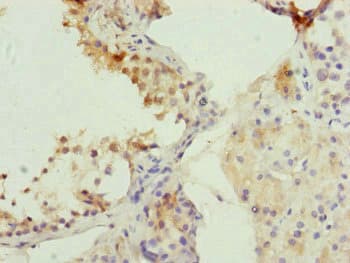 Polyclonal Rabbit anti-Human CDC45 Antibody (IHC, WB)