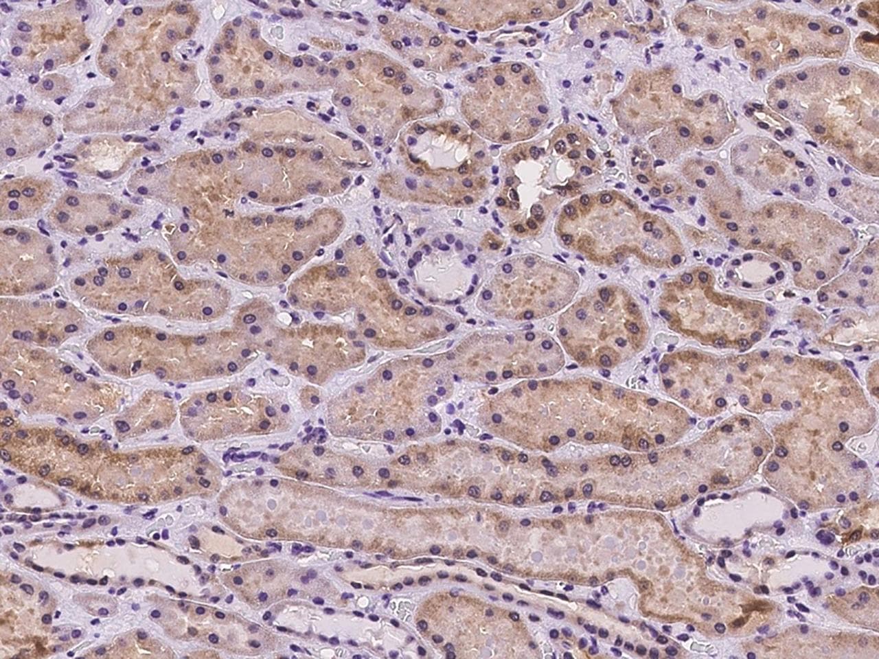 Polyclonal Rabbit anti-Human CLDN12 / Claudin 12 Antibody (IHC)