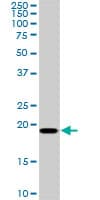 SRI / Sorcin Antibody (clone 1E12)