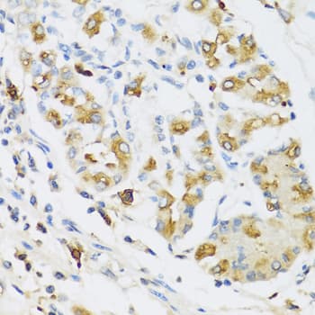 RNASE3 Antibody