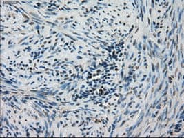 STK39 / SPAK Antibody (clone OTI4E3)