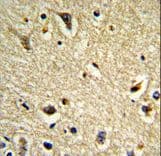 Polyclonal Rabbit anti-Human CYP2E1 Antibody (aa402-429, IHC, WB)