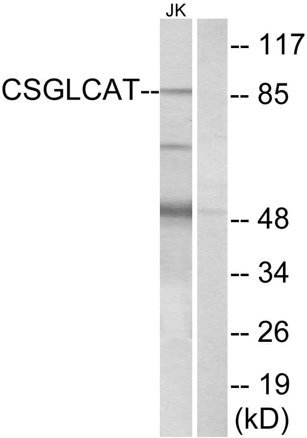 CHPF2 / CSGLCAT Antibody (aa31-80)
