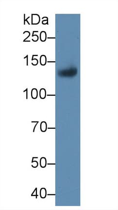 CD118 / LIF Receptor Alpha Antibody (aa642-791)