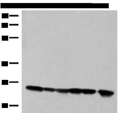 Thymidylate Kinase Antibody