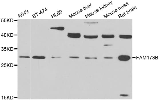 Polyclonal Rabbit anti-Human FAM173B Antibody (IHC, WB)