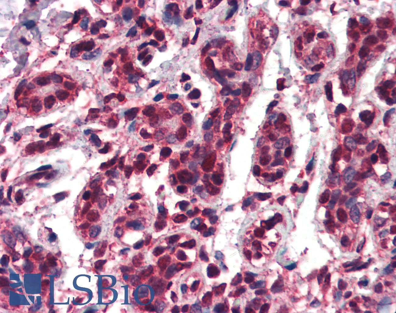 IHC-plus™ TCF3 / E2A Antibody (aa522-535)