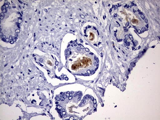 Monoclonal Mouse anti-Human CD63 Antibody (clone OTI2G6, IHC, WB)