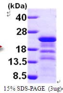 Human Immunodeficiency Virus 1 HIV-1 p24 Protein (Recombinant His)