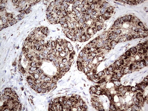 PIK3CD / PI3K Delta Antibody (aa286-610, clone OTI1D11)