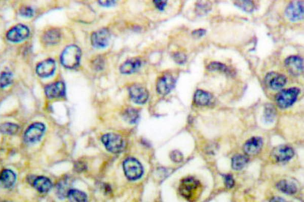 FGFR2 / FGF Receptor 2 Antibody (Val501)