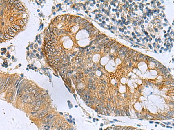 GCAP / GUCA1A Antibody