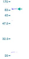 Human MTMR9 Protein (Recombinant GST)