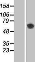 CAMK2B / CaMKII Beta Protein (Over-Expression Lysate Myc-DDK (Flag))