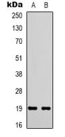 STMN1 / Stathmin / LAG Antibody (N-Terminus)