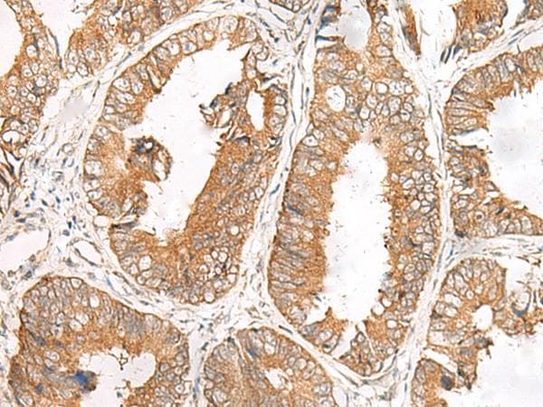 Polyclonal Rabbit anti-Human NATO3 / FERD3L Antibody (IHC)