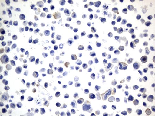 CD274 / B7-H1 / PD-L1 Antibody (aa19-290, clone UMAB229, Carrier-free)