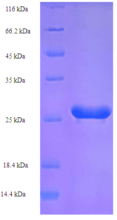 Human HPV52 E7 Protein (Recombinant His-SUMO)
