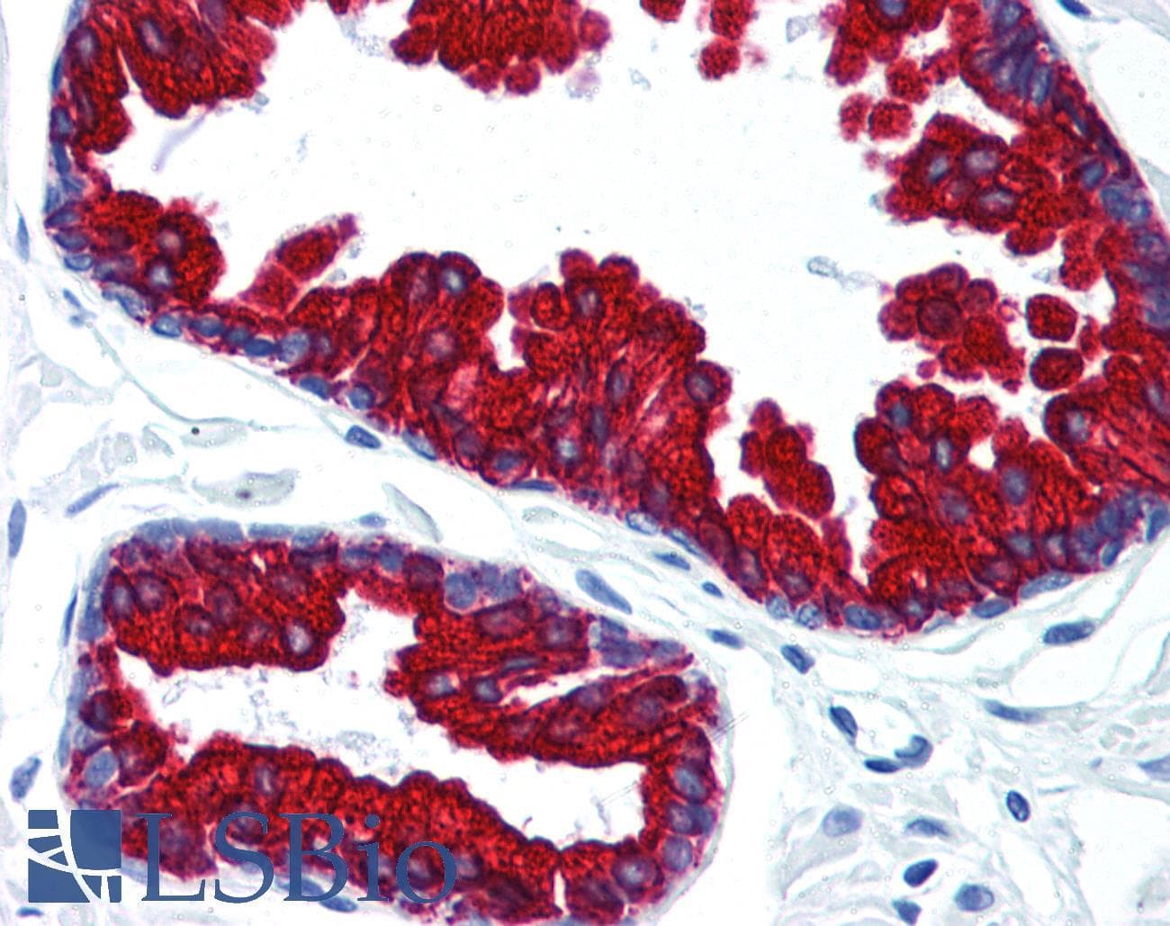IHC-plus™ Monoclonal Mouse anti-Human KRT18 / CK18 / Cytokeratin 18 Antibody (clone DA-7, IHC, WB)