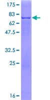 Human PNLIP / PL / Pancreatic Lipase Protein (Recombinant GST)