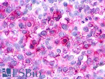 PathPlus™ Polyclonal Rabbit anti-Human CHEMR23 / CMKLR1 Antibody (N-Terminus, IHC)