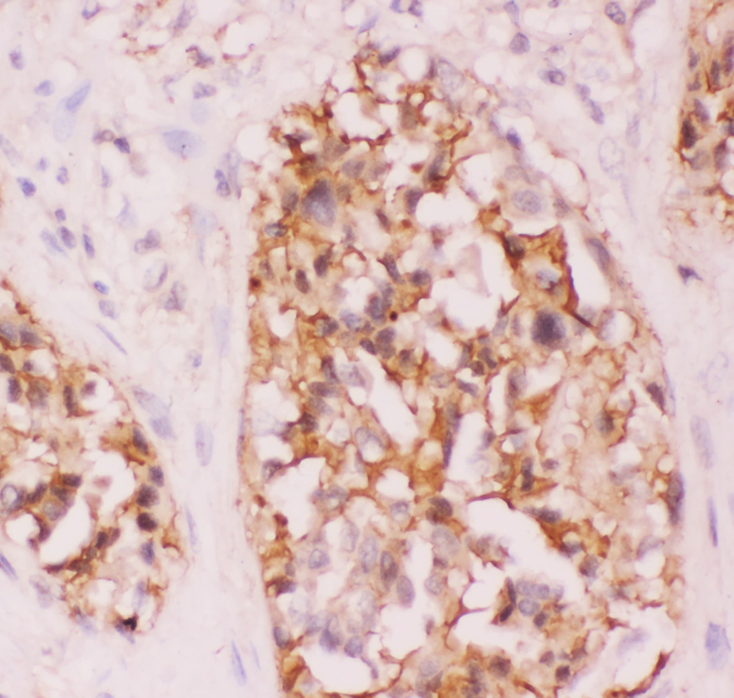 CRK Antibody (aa2-246)