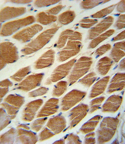 Polyclonal Rabbit anti-Human ACADL Antibody (aa292-319, IHC, WB)