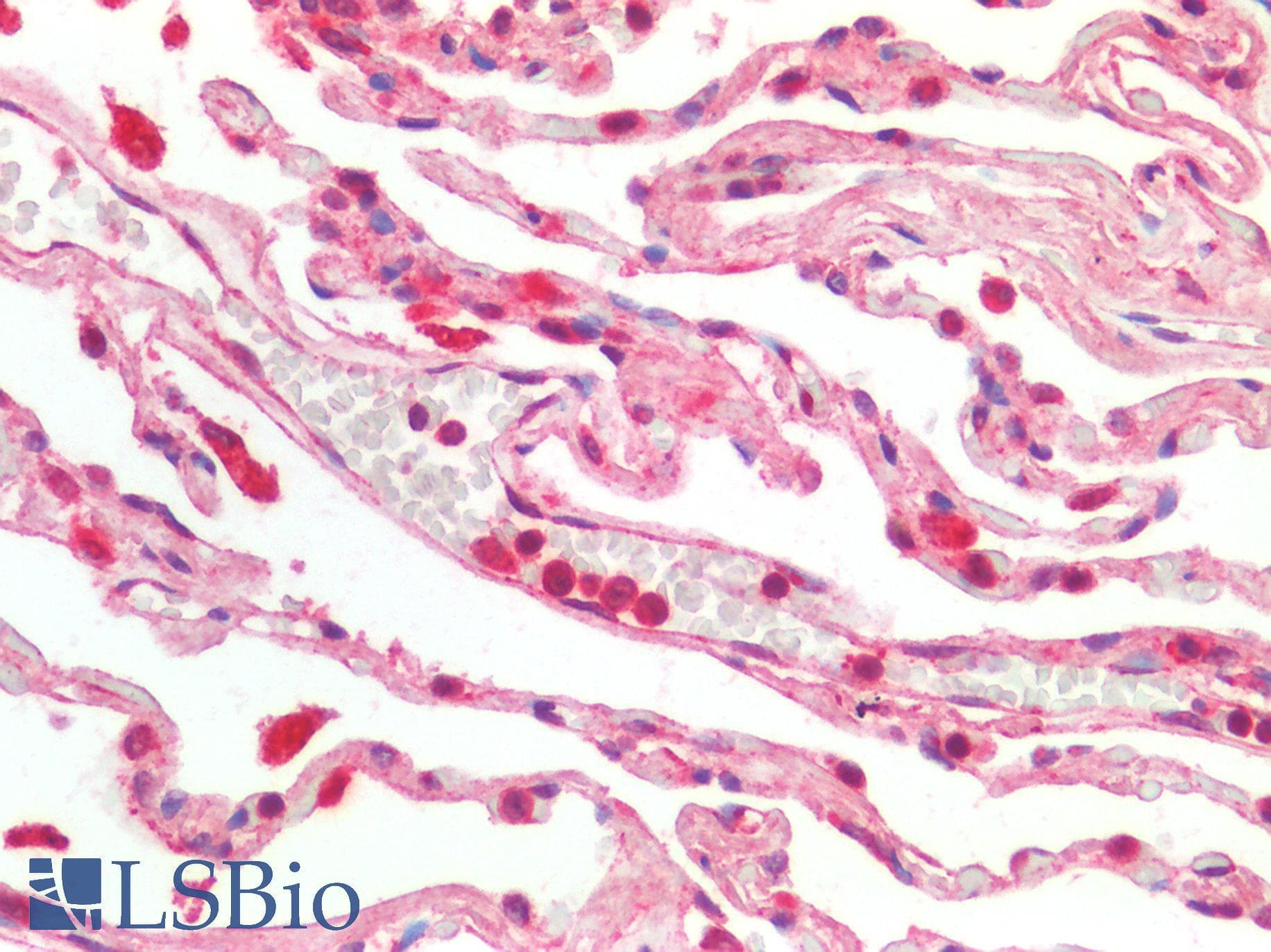 PathPlus™ ACE2 / ACE-2 Antibody