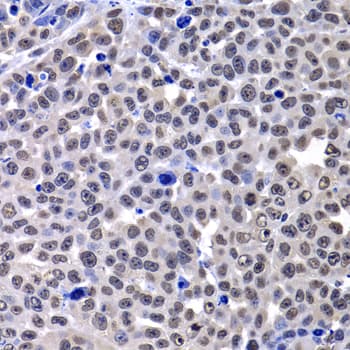 H2AFY / MACROH2A1 Antibody