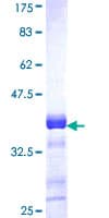 Human ACACB / ACC2 Protein (Recombinant GST, N-terminus)