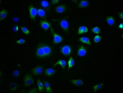 DVL2 / Dishevelled 2 Antibody (aa1-240)