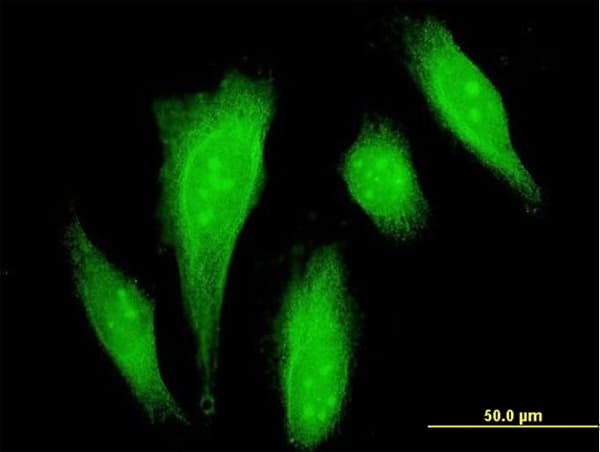 DAXX Antibody (clone 4C2)