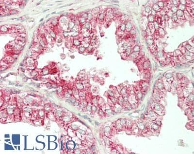 IHC-plus™ ERGIC-53 / LMAN1 Antibody (clone 2B10)