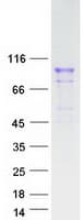 Human FGFR4 Protein (Recombinant Myc-DDK (Flag))