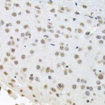ELAVL1 / HUR Antibody