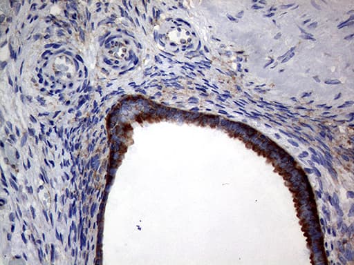 Monoclonal Mouse anti-Human DIRAS2 Antibody (clone OTI8A5, aa1-196, IHC, WB)