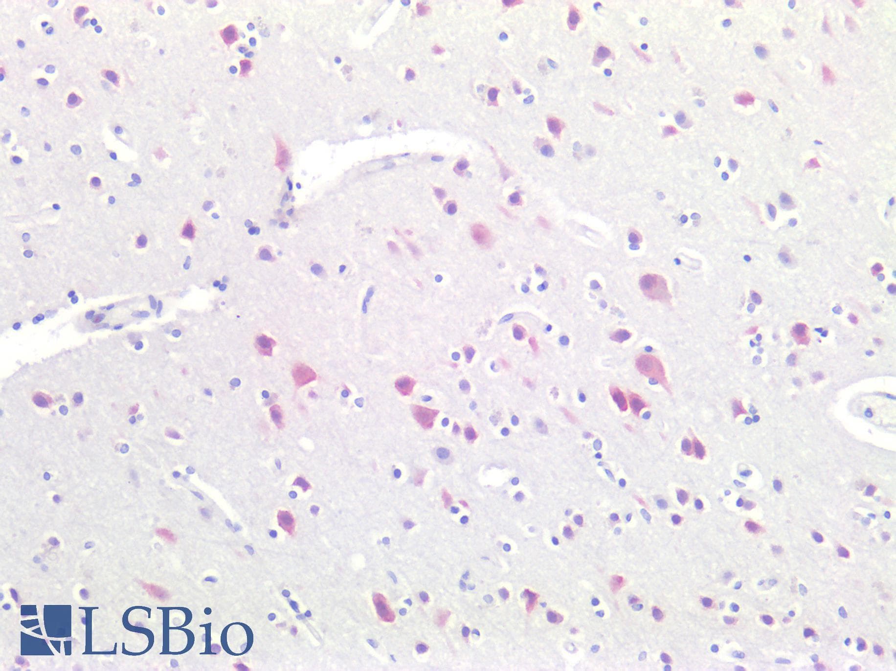 PathPlus™ RBFOX3 / NEUN Antibody