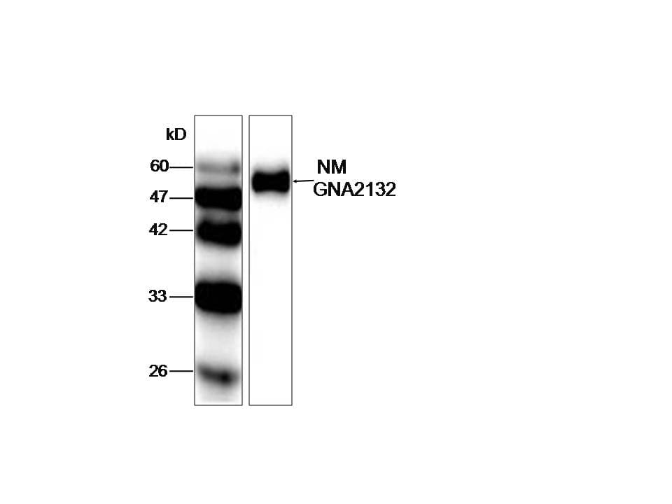 Neisseria meningitidis gna2132 Antibody (aa86-282)