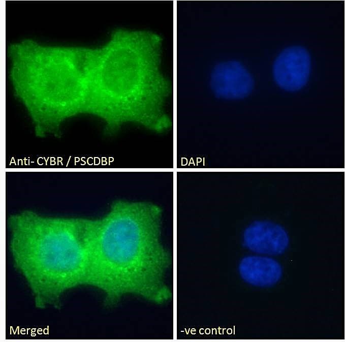 IHC-plus™ CYTIP Antibody (aa2-14)