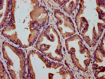 SLC26A9 Antibody