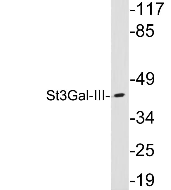 ST3GAL3 / ST3N Antibody (aa174-223)