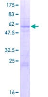 Human U2AF1 Protein (Recombinant GST)
