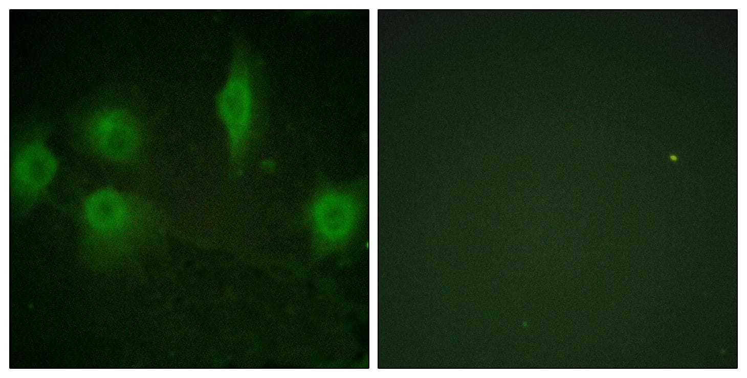 IL9R / CD129 Antibody (phospho-Ser519)