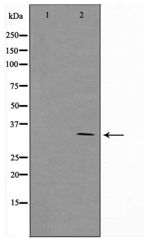 SURF1 Antibody
