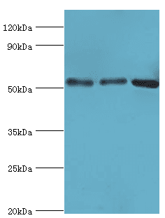 ANXA11 / Annexin XI Antibody (aa276-505)