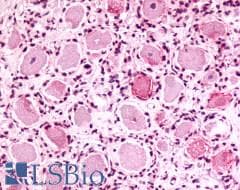PathPlus™ MRGPRX4 / MRGX4 Antibody (N-Terminus)