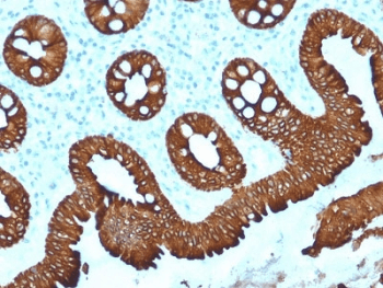 Monoclonal Mouse anti-Human KRT20 / CK20 / Cytokeratin 20 Antibody (clone KRT20/1992, IHC, WB)