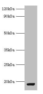 IHC-plus™ MYDGF / SF20 Antibody (aa32-173)