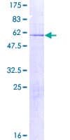Human AMMECR1 Protein (Recombinant GST)